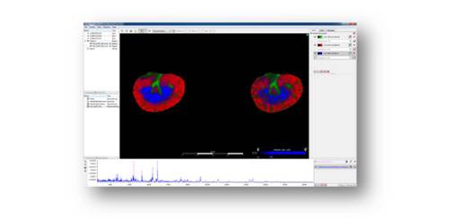 SCiLS LAB SOFTWARE