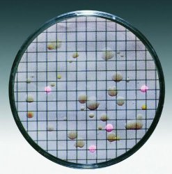 Membrane per Microbiologia
